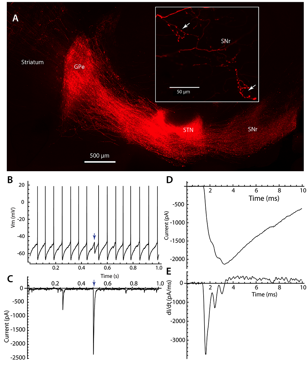 Indirect Pathway Control Of Firing Rate And Pattern In The Substantia Nigra Pars Reticulata